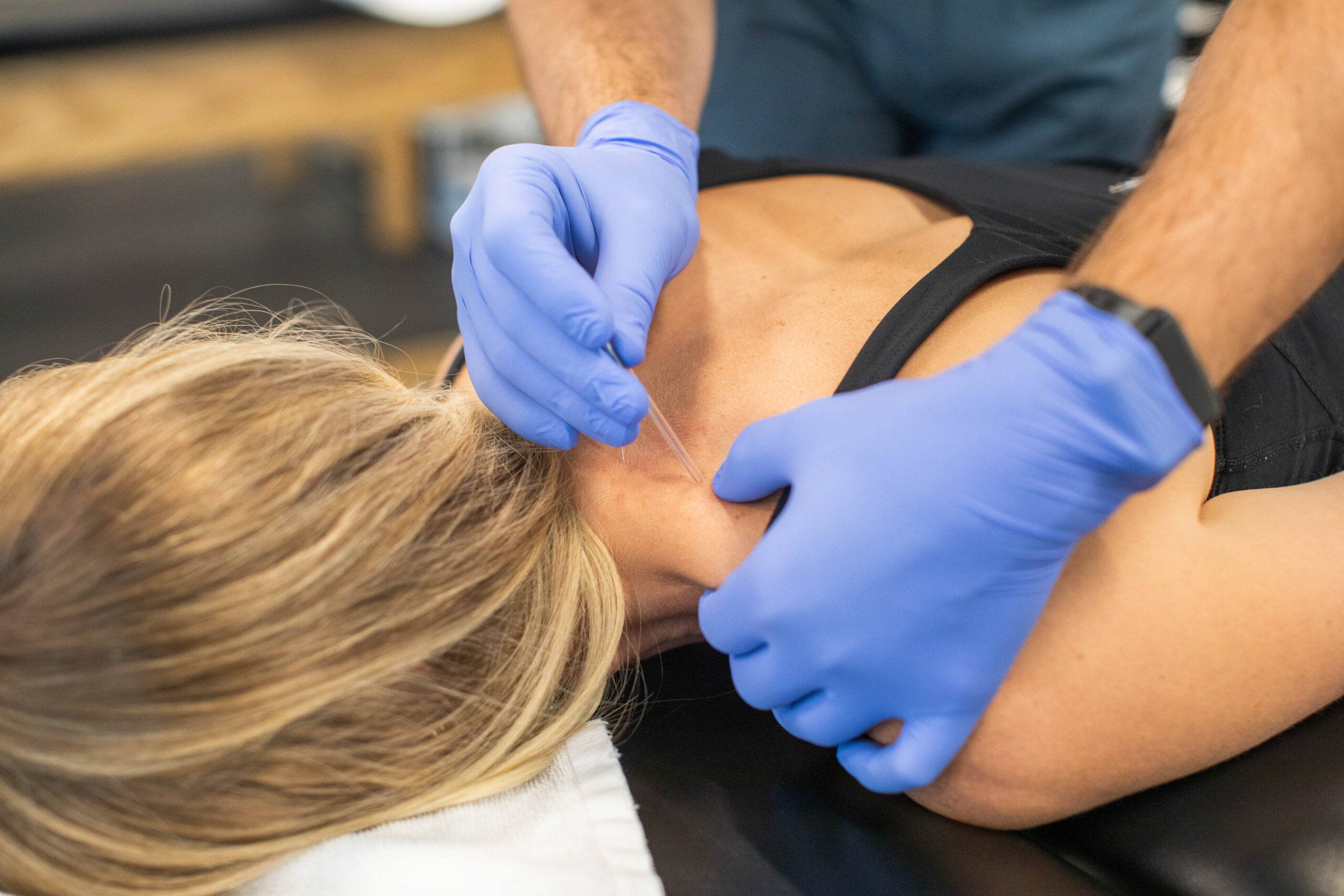 Can Dry Needling Help With Tennis Elbow?